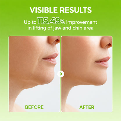 Lifting Mewing Band (4x Masks Per Pack)