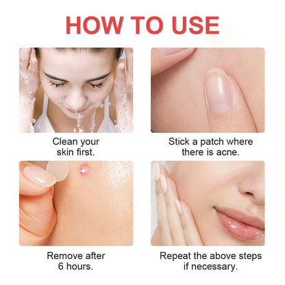 Hydrocolloid Acne Dots for Fast Blemish Care