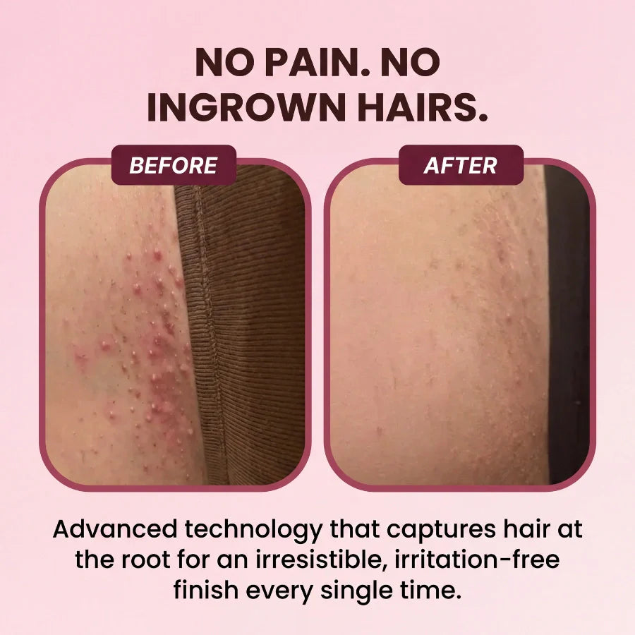 Gentle Zero-Irritation Shave Pro ✨