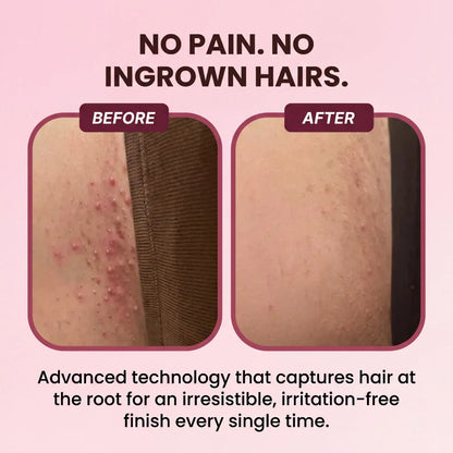 Gentle Zero-Irritation Shave Pro ✨