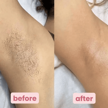 Gentle Zero-Irritation Shave Pro ✨