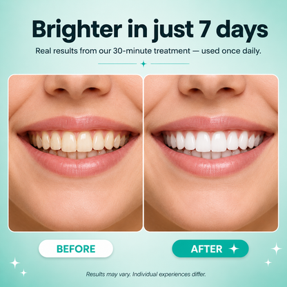 Whitening Strips – Professional Teeth Whitening in Just 30 Minutes