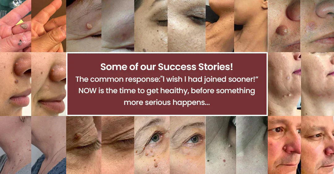 2-in-1 Microneedle Patch🧴 Clear Blemishes, Moles & Warts, Fade Scars, Invisible Face Body Use