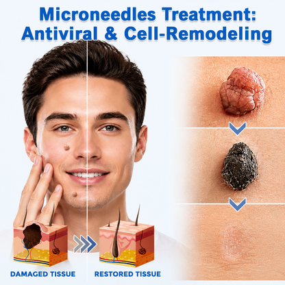 2-in-1 Microneedle Patch🧴 Clear Blemishes, Moles & Warts, Fade Scars, Invisible Face Body Use