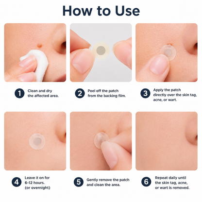 2-in-1 Microneedle Patch🧴 Clear Blemishes, Moles & Warts, Fade Scars, Invisible Face Body Use