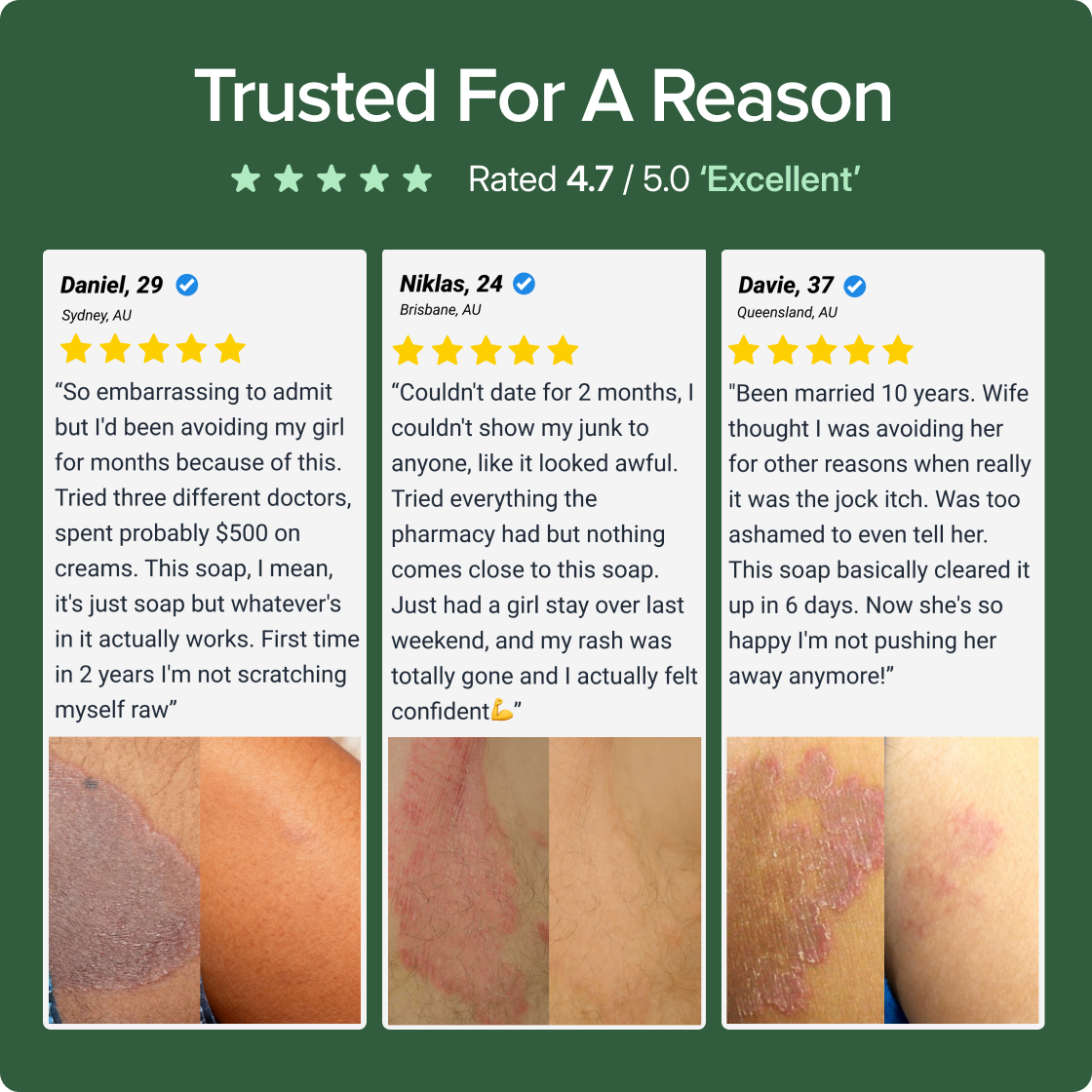 ✨ Soothing Antifungal Body Soap for Fungal Skin Issues