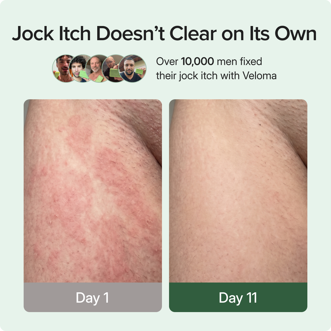✨ Soothing Antifungal Body Soap for Fungal Skin Issues