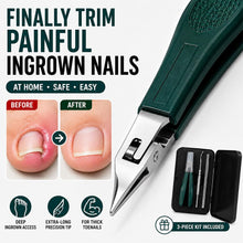 Wide Jaw Nail Clippers for Thick & Ingrown Nails