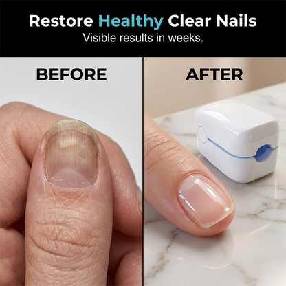 Portable Handheld Blue Light Device for Nail Care